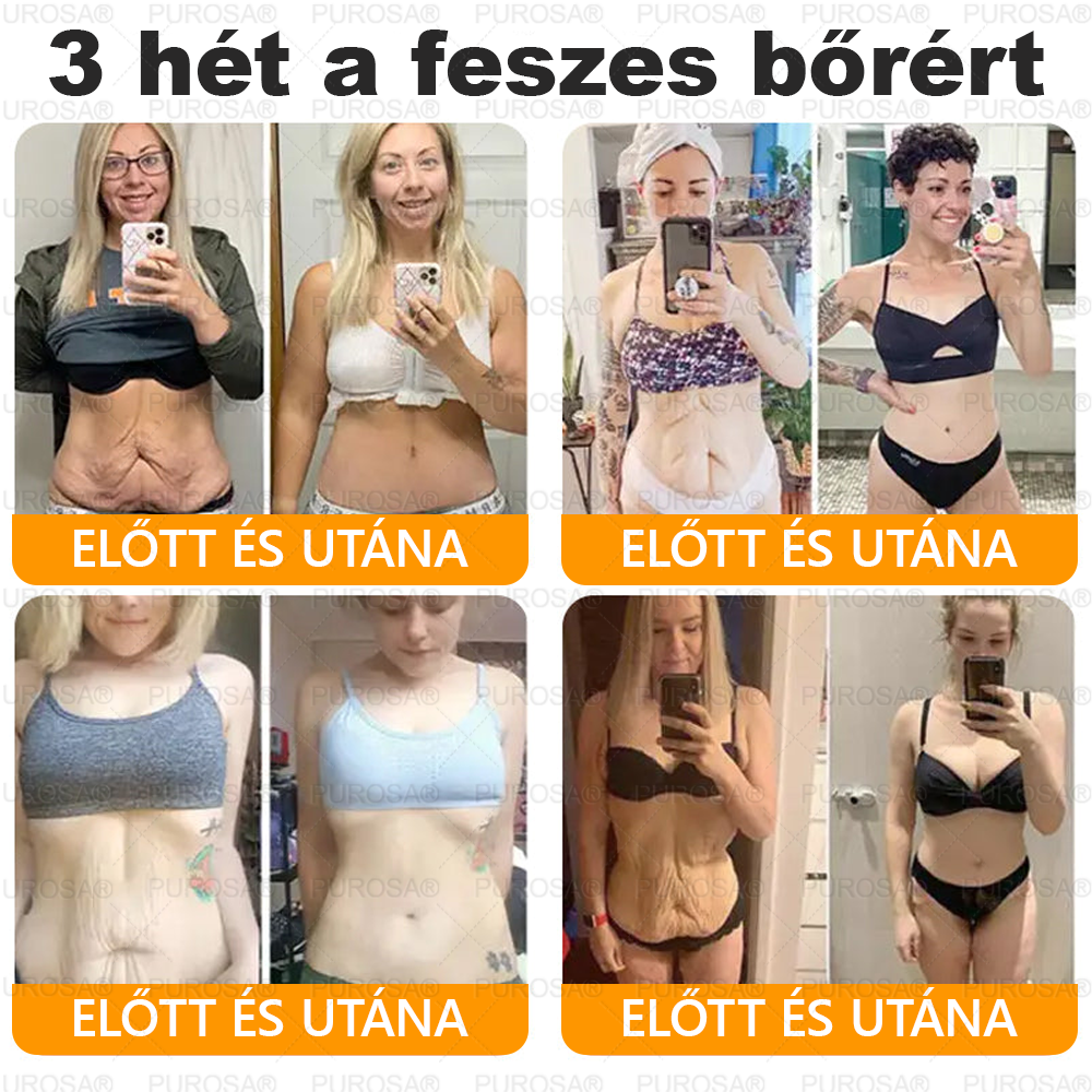 ✨ 🎁 Már csak az utolsó 5 doboz maradt! Korlátozott ideig extra 50% kedvezmény! Ragadd meg a lehetőséget a bőröd újjászületéséhez ✨Ha most lemaradsz, legközelebb csak jövőre lesz esélyed!