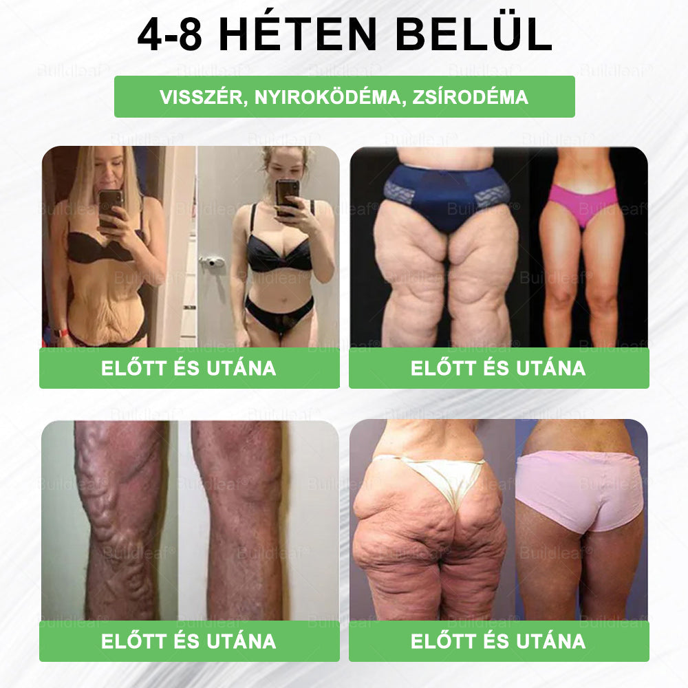 🌿 🎁 Már csak 10 doboz maradt! Korlátozott ideig érvényes ajánlat, extra 50% kedvezmény! Ragadd meg ezt a lehetőséget, hogy karcsúbb, energikusabb életet élj. Ha lemaradsz, jövő évig kell várnod!