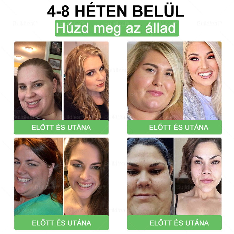 🌿 🎁 Már csak 10 doboz maradt! Korlátozott ideig érvényes ajánlat, extra 50% kedvezmény! Ragadd meg ezt a lehetőséget, hogy karcsúbb, energikusabb életet élj. Ha lemaradsz, jövő évig kell várnod!